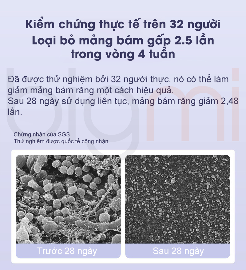 Ban chai dien Xiaomi Mijia Sonic T302 MES608 lam sach hieu qua sau 4 tuan