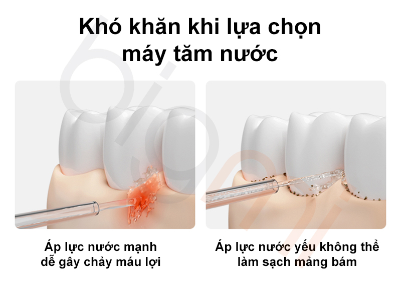 May tam nuoc Xiaomi Mijia 2 MEO705 kho lua chon
