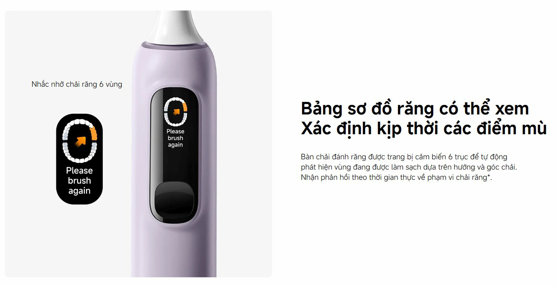 Ban chai dien Xiaomi Pro MES610 Oscillation Electric Toothbrush bigmivn 5
